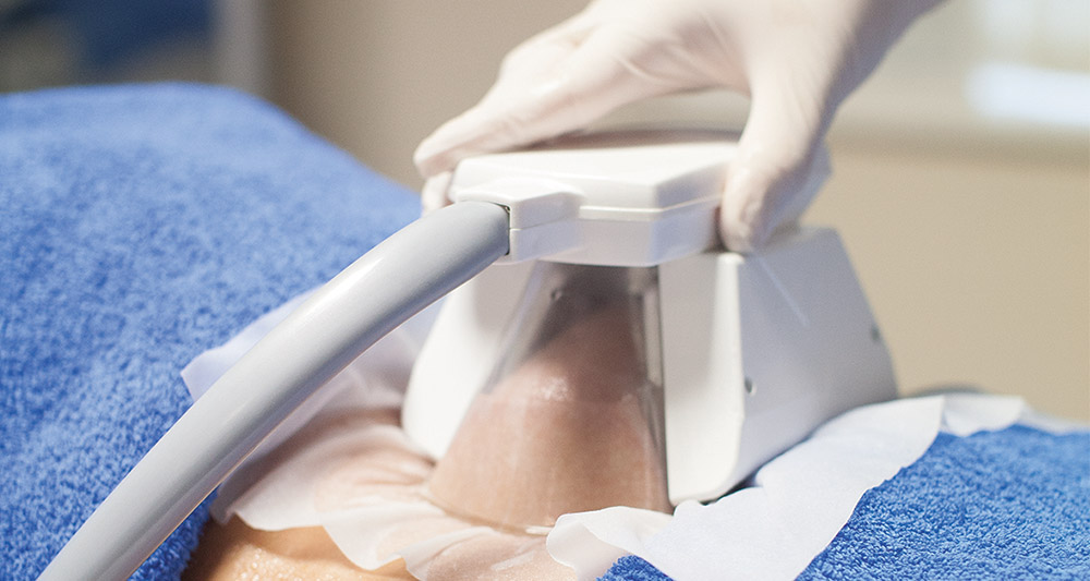 How Fat Freezing and HIFU Work Together? 2 Multiple Areas in One Session HIFU and Fat Freezing Sandwich