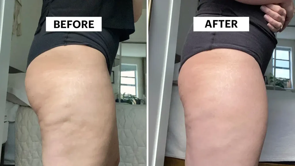 Do Toning Exercise Sandwich Really Tackle Cellulite?