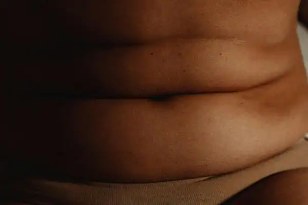 The Hidden Connection: How Stress Shapes Your Fitness and Body Composition 3 image of what stress can do on the stomach area and how Lipo 360 Sandwich can help to change your body shape.